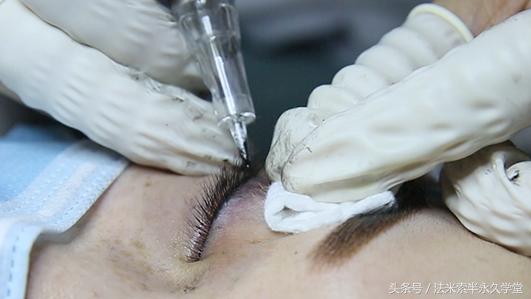 纹唇后的晕色期是什么意思,眉眼凹陷怎么修复