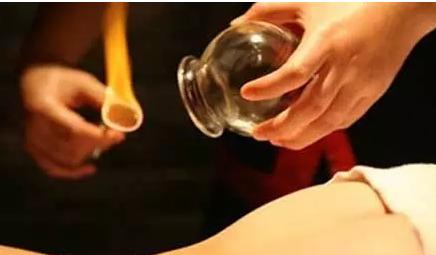 腰肌劳损梨状肌做针灸拔罐有用吗,腰肌劳损拔罐关注事项