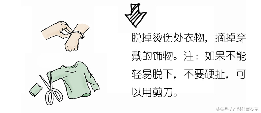 宝宝烫伤的家庭正确处理流程