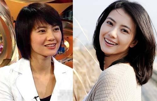 成人矫正牙齿的后遗症,成年人牙齿矫正的三大后遗症