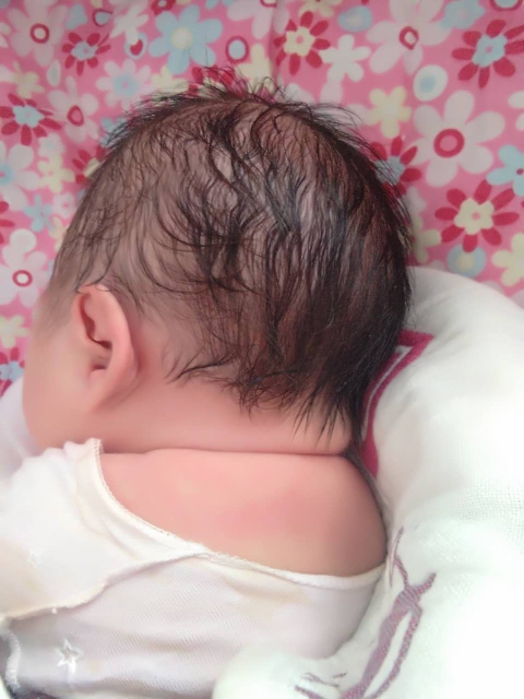 产后出血700ml算不算大出血,产后大出血2800毫升