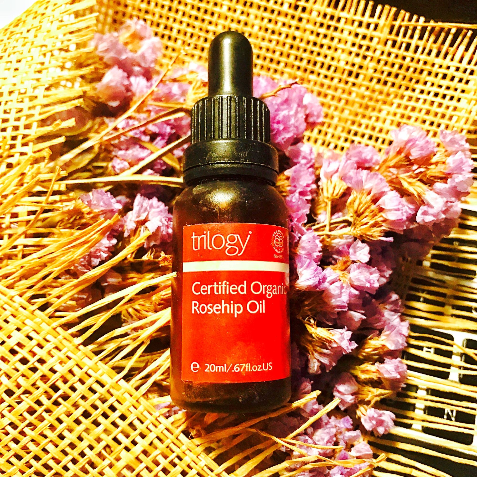 蒋勤勤皮肤过敏,蒋勤勤过敏怎么治疗