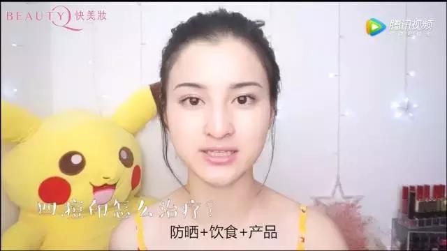 是什么让你长痘痘,什么能导致长痘