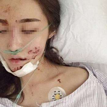 微整美容院骗局曝光,私人美容工作室做微整