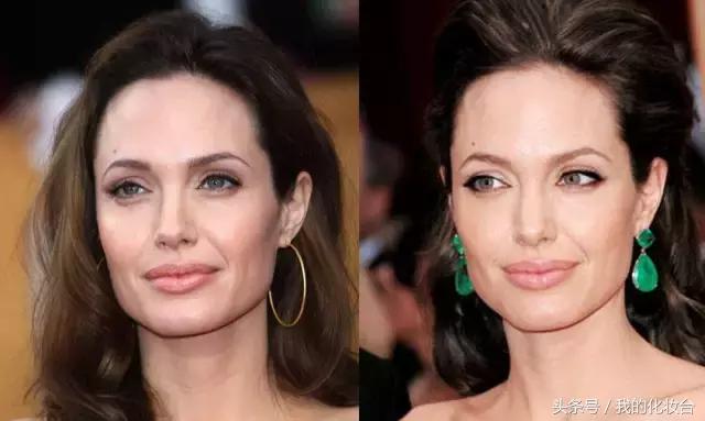 脸宽除了削骨还有什么办法,除了削骨还有什么办法让脸型流畅