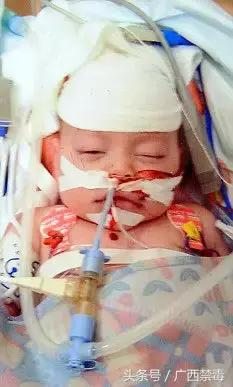 刚出生的婴儿被灌安眠药,刚出生的婴儿被父母放进福尔马林