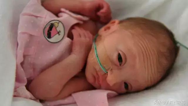 刚出生的婴儿被灌安眠药,刚出生的婴儿被父母放进福尔马林