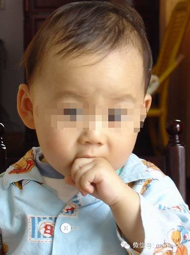 宝宝喜欢咬手指起茧子,宝宝吃手时咬手怎么戒