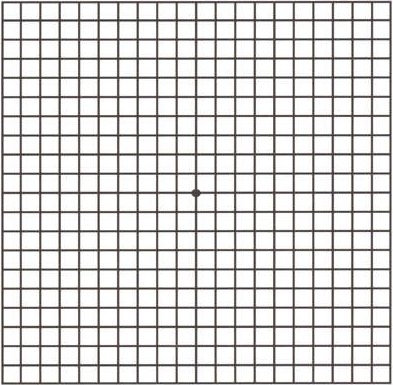 得了黄斑病变还能玩手机,得了黄斑病症状