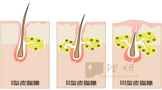 痘疮最好的治疗方法,疮痘是什么