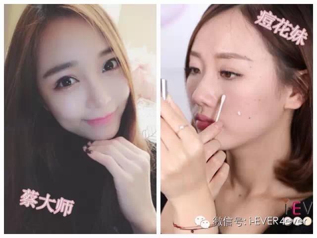 祛痘教你一招,超简单的祛痘小方法