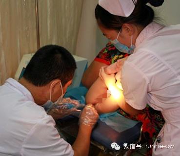 小儿肛周围脓肿怎么处理,宝宝肛周渗血