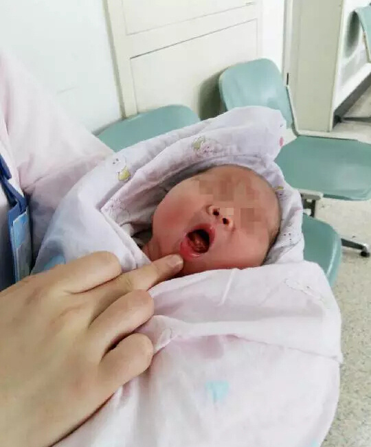 小孩有没有生下来就长牙,小宝宝才一个月就长牙了