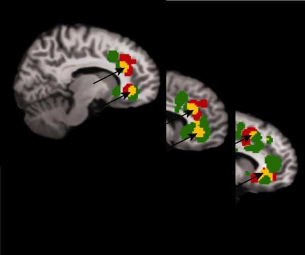 分手了真的难受到心疼,分手时心疼的句子