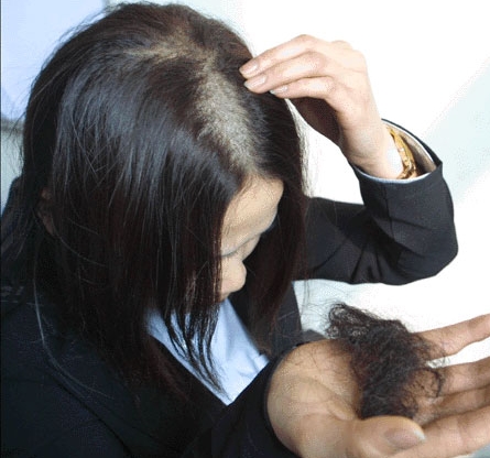 脱发是病,脱发是身体的什么问题