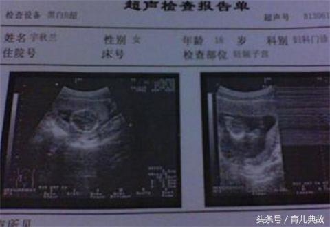 人流一个多月又怀孕了怎么办,做完人流半年又怀孕先兆流产了