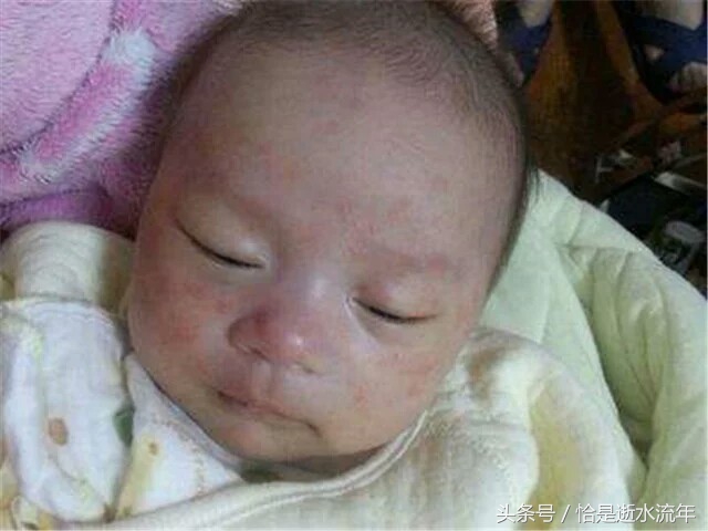 妈妈关注这些食物别给宝宝吃,妈妈饮食不当导致宝宝过敏怎么办