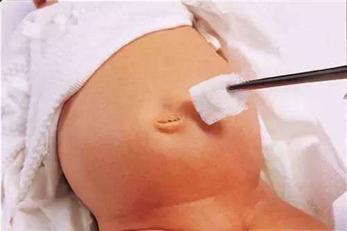 身体哪五个部位不能太干净,身体6个部位太干净容易生病