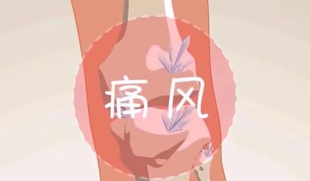 就医搜｜每10人中就有1人中招！高尿酸血症真的与你无关？