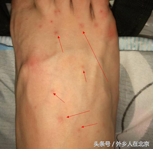 出租屋有很小的虫子是什么原因,新入住的房子里有小虫子