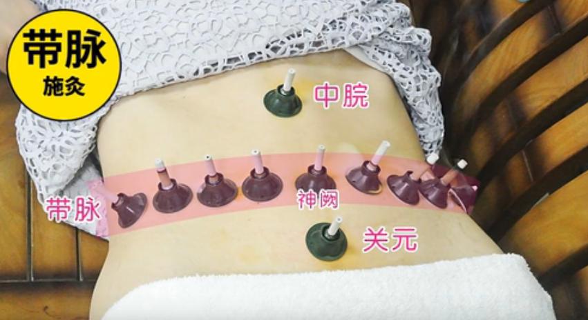 做艾灸都应该知道的4组穴位！可调理一切妇科病！