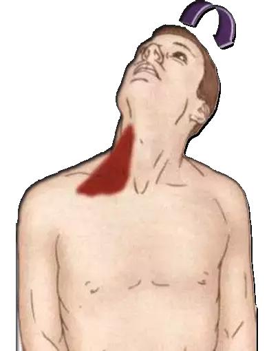 颈椎痛肩膀痛胳膊发凉怎么回事,颈部肩膀手臂麻痛