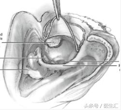 听力低频降落怎么恢复,低频听力降落耳鸣怎么治疗