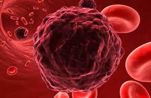 就医搜｜每10人中就有1人中招！高尿酸血症真的与你无关？