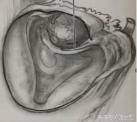 听力低频降落怎么恢复,低频听力降落耳鸣怎么治疗