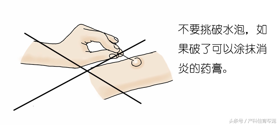 宝宝烫伤的家庭正确处理流程