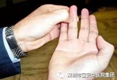 中医如何调理小儿过敏性咳嗽,中医小儿过敏性咳嗽怎么调理