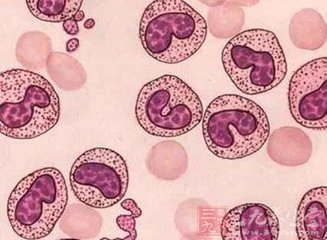 肾病复发几次就会肾衰竭与尿毒症,专治肾病的6大技巧