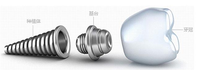 牙齿缺失了还能矫正吗,牙齿缺失会越长越丑吗