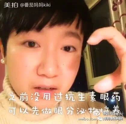 宝宝眼睛黄色眼屎导致眼睛发红,宝宝眼睛眼屎多黄稠怎么解决