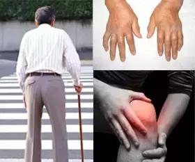 对风湿骨病有效的中药,各种风湿骨病的克星