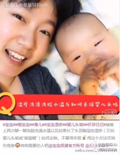 幼儿头垢和湿疹结痂的区别,湿疹洗澡用什么清洗