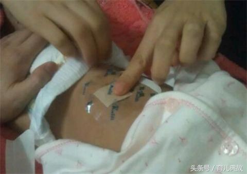 一个月的宝宝肚脐上有点鼓,两个月宝宝肚脐凸起按压有水声