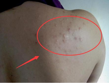 洗澡搓出来泥有好处吗,为什么洗澡脸上能搓出泥