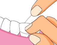 塞牙塞的厉害怎么办,塞牙塞到牙龈里咋回事