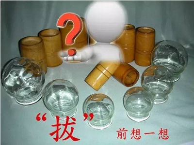 类风湿拔罐刮痧有帮助吗,类风湿拔罐放血有效果吗