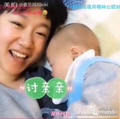 幼儿头垢和湿疹结痂的区别,湿疹洗澡用什么清洗