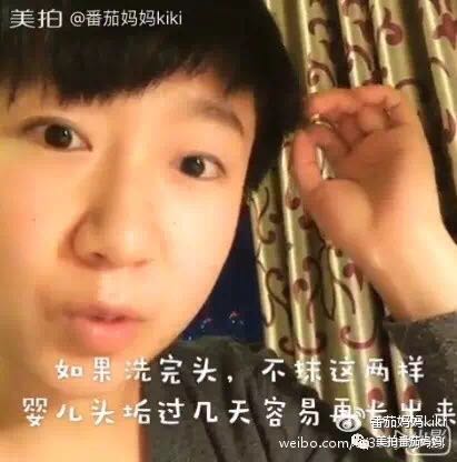 幼儿头垢和湿疹结痂的区别,湿疹洗澡用什么清洗