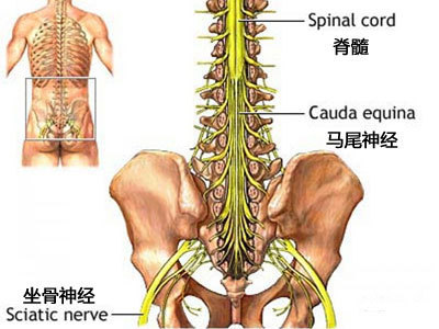 治疗坐骨神经痛正确锻炼视频,一招根治坐骨神经痛