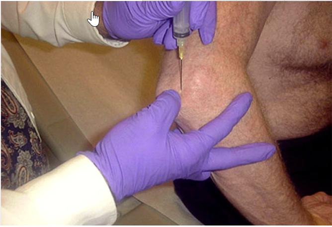 痛风常见的100个常识,痛风症治疗及预防方法