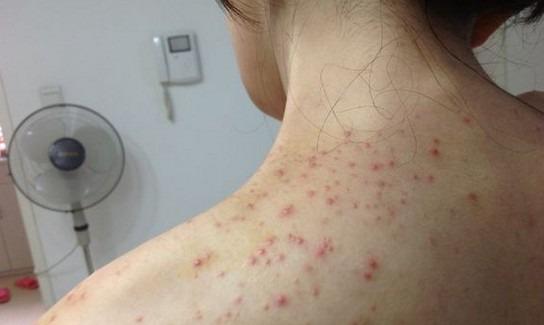 农村有什么植物健脾祛湿,除湿气植物有哪些