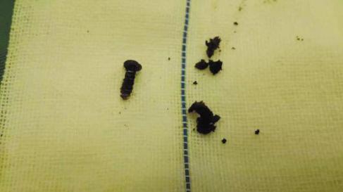 宝宝拼命抓耳朵身体发出求救信号,三个月小孩一直抓耳朵