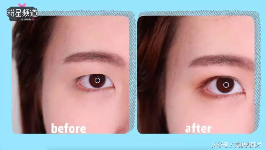 细长双眼皮贴小内双教程,最全双眼皮贴教程