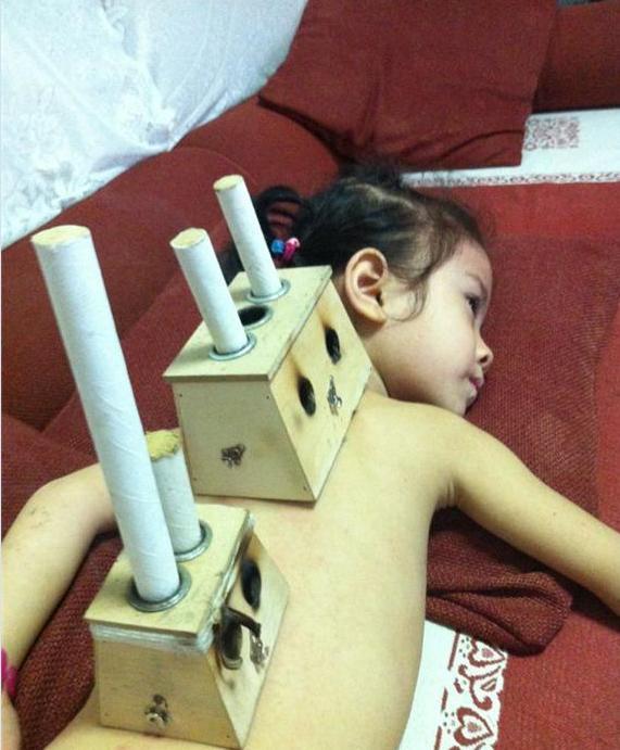 夏天湿气重的症状和表现,民间说身体湿气太重怎样除掉