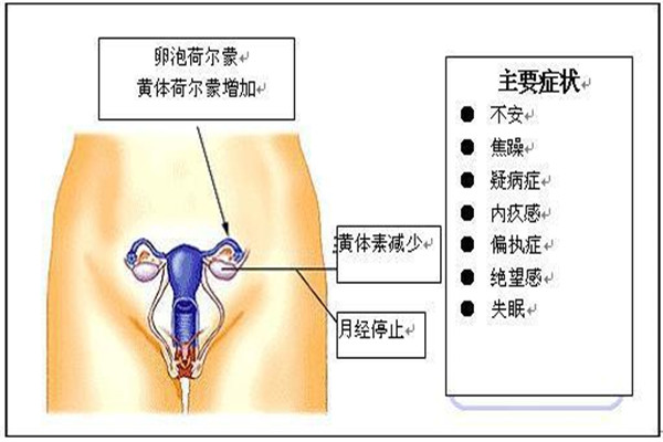 女性围绝经期综合征如何调理,围绝经期综合征病人的护理ppt