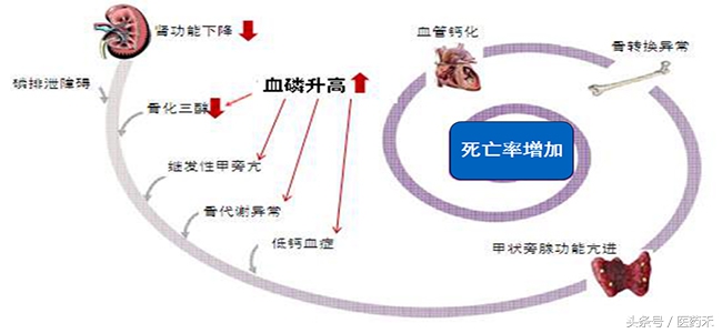 慢性肾病及尿毒症病人必读书籍,肾病五期最常见的是高磷血症